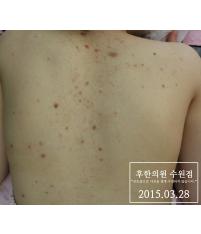 전후사진