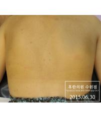 전후사진