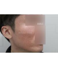 전후사진
