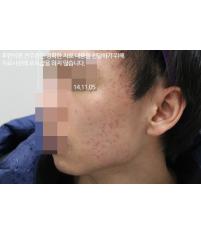 전후사진