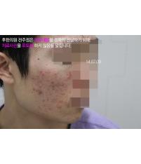 전후사진