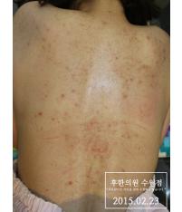 전후사진