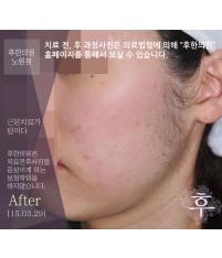 전후사진