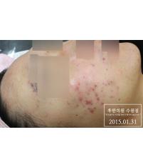 전후사진