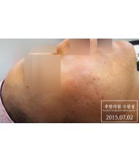 전후사진