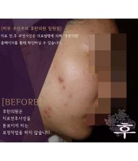 전후사진