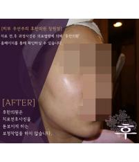 전후사진