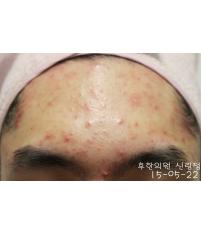 전후사진