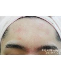 전후사진