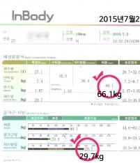 전후사진
