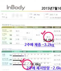 전후사진
