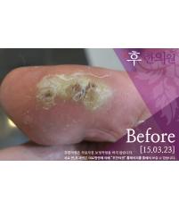 전후사진