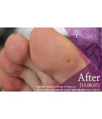 전후사진