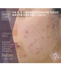 전후사진
