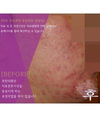 전후사진