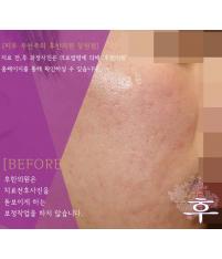 전후사진
