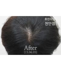 전후사진