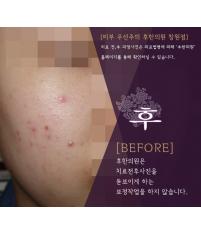 전후사진