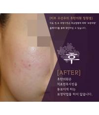 전후사진