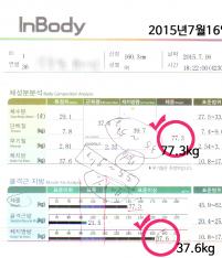 전후사진