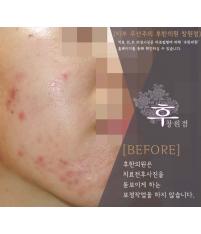 전후사진