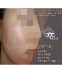 전후사진
