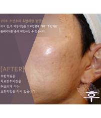 전후사진