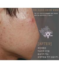 전후사진