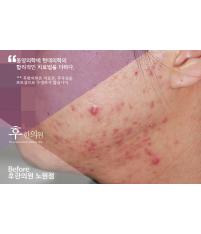 전후사진