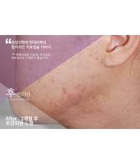 전후사진