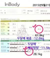 전후사진