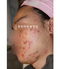 전후사진