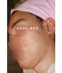전후사진