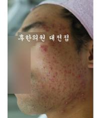 전후사진