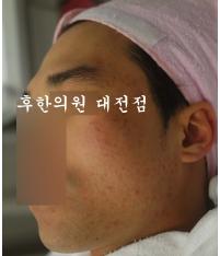 전후사진