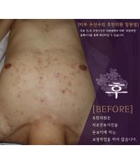 전후사진