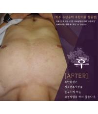 전후사진