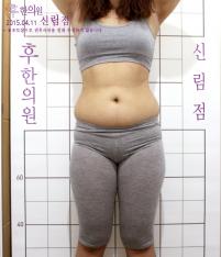 전후사진