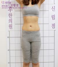 전후사진