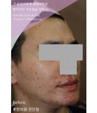 전후사진