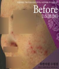 전후사진