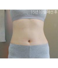 전후사진