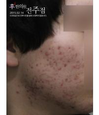 전후사진