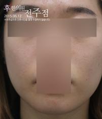 전후사진