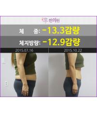 전후사진