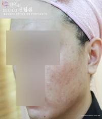 전후사진