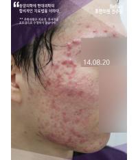 전후사진