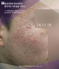 전후사진