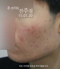 전후사진