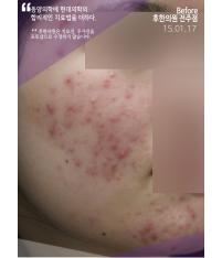 전후사진